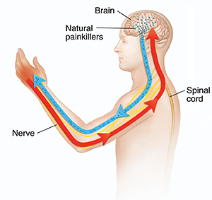 Outline of human figure showing brain and spinal cord. Arrows show pain signals to and from brain.